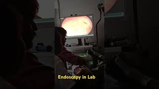 endoscopicprocedure endoscopy Endoscopy procedure in Gaestro hospital [upl. by Enoved450]