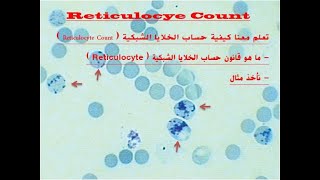 Reticulocyte Count [upl. by Rento375]