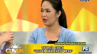 How to identify symptoms of goiter [upl. by Anyar]