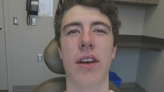 FUNNY WISDOM TEETH AFTERMATH  Tooth Removal Video w TheCampingRusher [upl. by Gerry985]