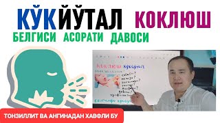 КЎКЙЎТАЛ КОКЛЮШ ТАРҚАЛИШИ САБАБИ БЕЛГИСИ АСОРАТИ ТАШХИС ВА ДАВО ЧОРАЛАРИ ҲАҚИДА МАЪЛУМОТ [upl. by Blanche42]