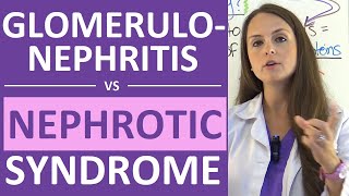 Nephrotic Syndrome vs Glomerulonephritis  Nephritic vs Nephrotic Syndrome Nursing NCLEX [upl. by Amilb]