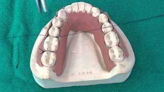 Peridontal Suturing Techniques [upl. by Arocat]