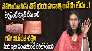 Diet amp Treatment for Psoriasis Patientsపేర్మినెంట్ క్యూర్ లేదు కానీ రోగనిరోధకశక్తిని ఇలాపెంచుకోండి [upl. by Frum]