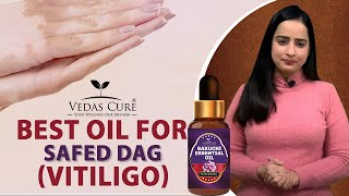 Best Oil For Safed Dag  Vitiligo   Bakuchi Oil by Vedas Cure [upl. by Atinrehs791]