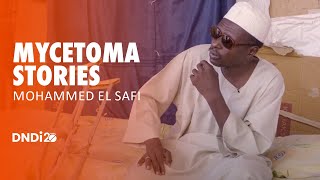 Mycetoma stories Mohammed El Safi [upl. by Manus]