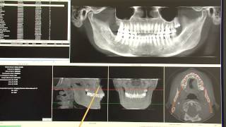 Dr Iván és Tsa Fogorvosi rendelő Zalaegerszeg  3D CT koponya röntgen diagnosztika [upl. by Angrist]