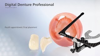 Digital Denture – fourth Appointment [upl. by Ardnuahc494]