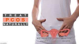 Treat PCOS Naturally  Nutritionist Guide [upl. by Elena]