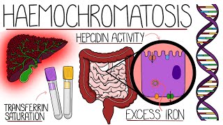 Understanding Haemochromatosis Hereditary amp Secondary [upl. by Kroo]