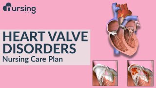 How heart valve disorders occur and caring for heart valve disorders Nursing Care Plan [upl. by Buderus]