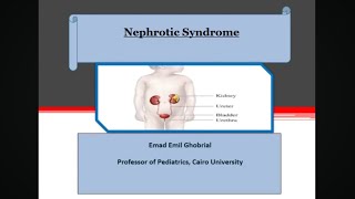 Nephrotic presentation Prof Emad Emil Prof of Pediatrics and Pediatric Nephrology [upl. by Skipp]