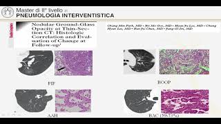 Introduzione alla Pneumologia Interventistica [upl. by Dewain]