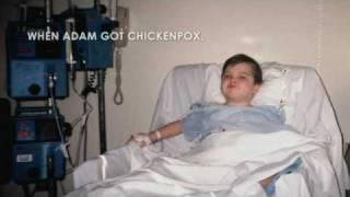 Chickenpox A Familys Story full video [upl. by Brett]