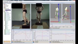 Biomechanical Screening of lower body in 3D with Simi [upl. by Chappie]