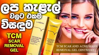 TCM Scar Removal Gel  For Acne Marks Scars And Stretch Marks  Cosmetics Sri Lanka  Beauty Lovers [upl. by Kenta475]