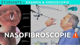 Comment réaliser une Nasofibroscopie  Formation étudiant ORL [upl. by Ahsahtan]