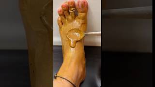 Whitening Feet for 5 min With Home Naturally Trickskincare facepack youtubevideo viralvideos [upl. by Wichern]