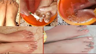 Pedicure at home 😍feet whitening Suntan Remove 🌞viralvideo natural remedies vlog [upl. by Marti]