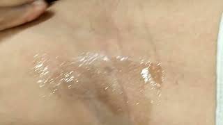 aaj me karungi lipo transparent wax se underarviral [upl. by Hebner]