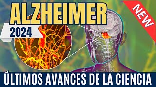 ¿QUÉ HAY TRÁS EL ALZHEIMER Toda lo que debes saber sobre enfermedad y los avances científicos [upl. by Eelahc60]