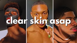 how to get clear skin for guys asap no bs guide [upl. by Yecies]