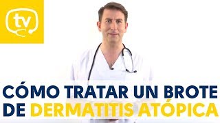 El tratamiento de los brotes de dermatitis atópica en niños [upl. by Malory228]