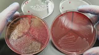 Microbiology GPC GNC GNCB Colonial Growth on BAP amp CHOC [upl. by Ramo]