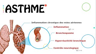 Asthme état stable 😷  Résumé  PneumoPhtisiologie [upl. by Edythe]