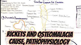 Rickets And Osteomalacia umerfarooqbiology7083 [upl. by Bright]