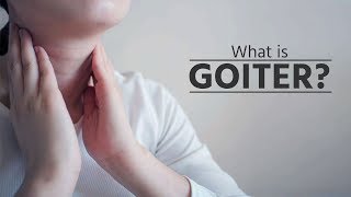 What is goiter  what is goiter disease  what is goiter thyroid  what is goiter symptoms [upl. by Lordan]