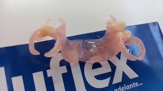 prótese flexivelPrótese flexível Sacavém Próteses dentárias estéticas Lisboasacavém [upl. by Marentic]