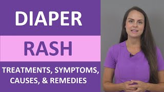 Diaper Rash Treatment Causes Symptoms Cream Ointment Home Remedies  Pediatric Nursing [upl. by Chantalle]