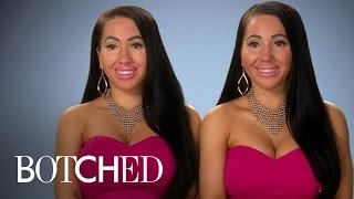 Identical Twins Mad Over Unidentical Boobs  Botched  E [upl. by Nilhsa]