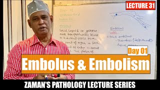 General Pathology Lecture 31  Embolus and Embolism  Day 1 [upl. by Pacien]