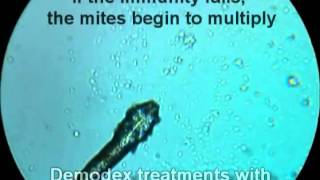 Demodex Folliculorum How to Cure Demodex [upl. by Aicinod]