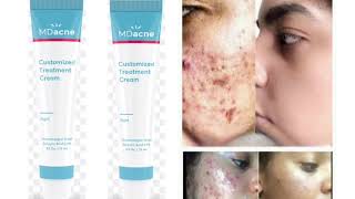 MDacne Acne Treatment Benzoyl Peroxide Cream Pores [upl. by Blakeley]