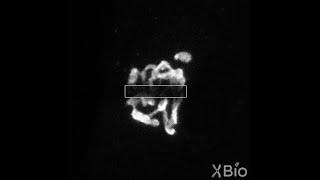 Fluorescence Recovery After Photobleaching [upl. by Lekzehcey]