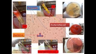 E coli and pus cells in urine [upl. by Ennovart]