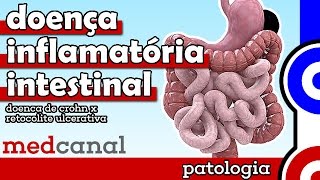 Doença Inflamatória Intestinal  PATOLOGIA [upl. by Orodoet474]