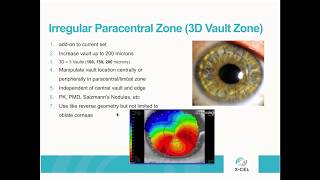 Webinar Adv Customization with Atlantis Scleral for Regular and Irregular Corneas 3DVault and MF [upl. by Tamra]