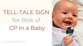 TELLTALE SIGN for Risk of Cerebral Palsy CP in a Baby [upl. by Koval336]