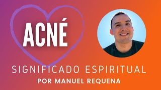 Acné Significado espiritual  por Manuel Requena [upl. by Eitac]