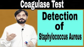 Coagulase Test  Procedure of Coagulase Test [upl. by Inesita]