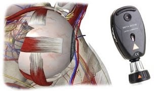 Fundoscopy in 5 min [upl. by Darrow]