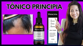 Dicas para tratar queda de cabelo em casa [upl. by Eltsyek]