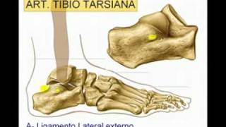 Artroscopia de tobillo [upl. by Llezo]