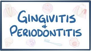 Gingivitis and periodontitis  causes symptoms diagnosis treatment pathology [upl. by Eiralih]