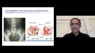 Managing GI Complications  Professor Qasim Aziz  English EN [upl. by Eadas778]