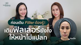 เติมฟิลเลอร์ยังไงให้หน้าไม่แปลก Filler แก้ปัญหาได้แต่อาจจะไม่ใช่ทุกอย่าง✨✨ [upl. by Aday482]